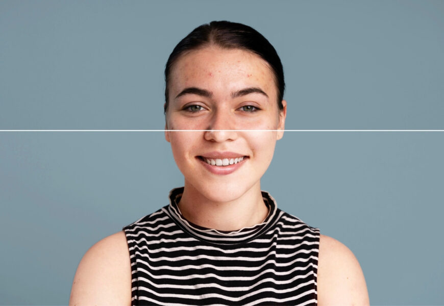 photo retouching in photoshop