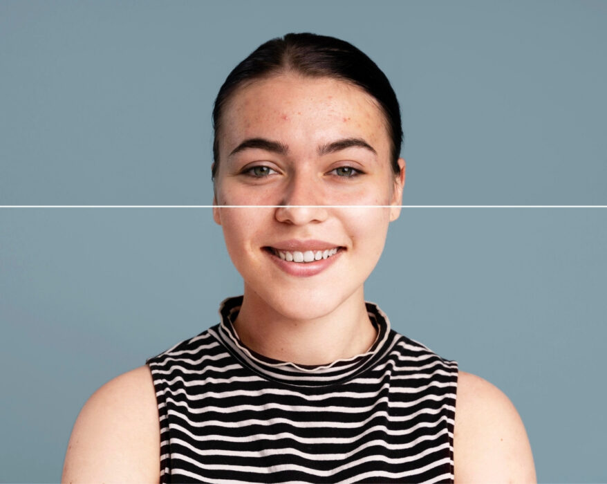 photo retouching in photoshop